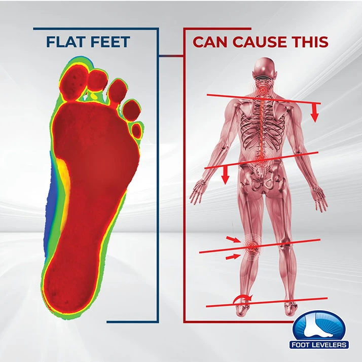 Chiropractic South Charlotte NC Foot Levelers